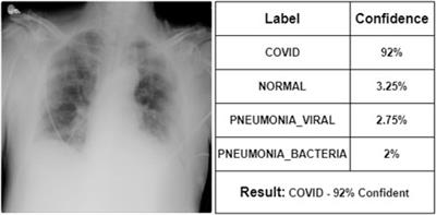 CovRoot: COVID-19 detection based on chest radiology imaging techniques using deep learning